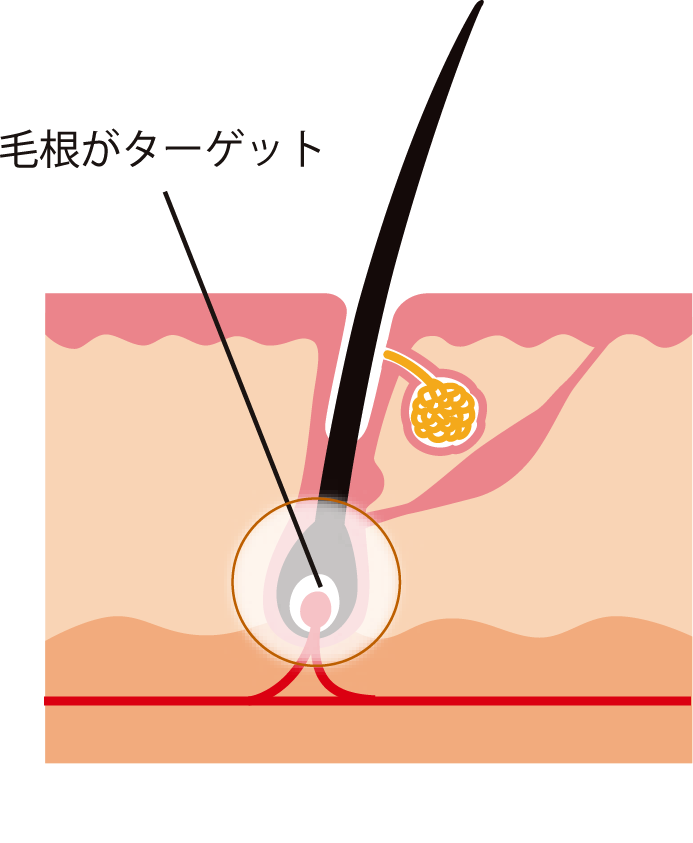 毛根がターゲット